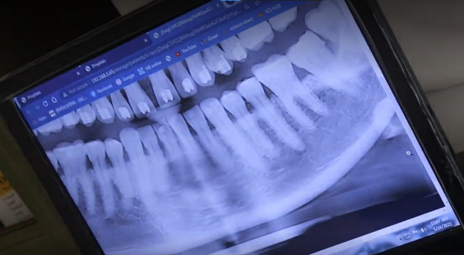 Radiography Program